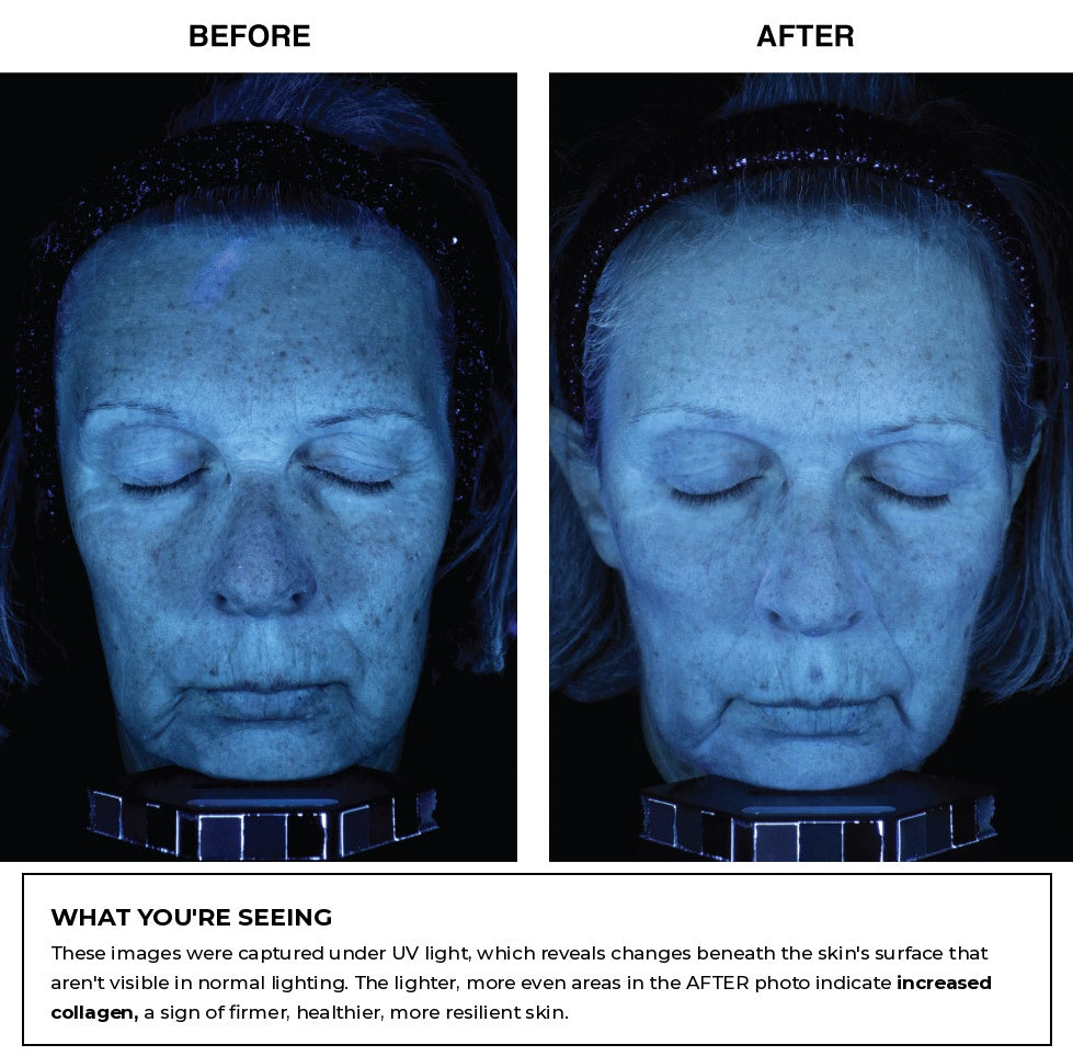 Skin Memory Serum — manufacturer comparison photo